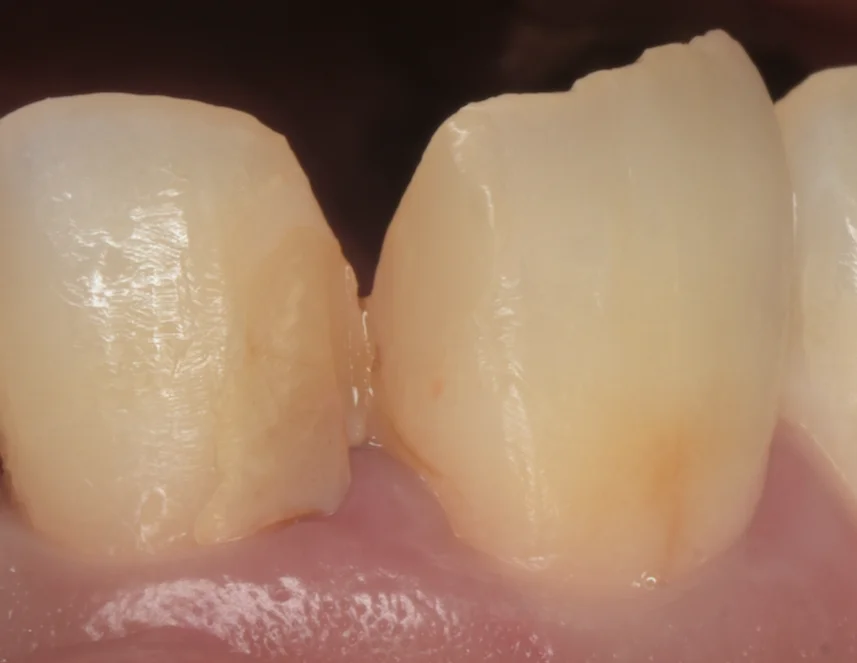 ブログ・お役立ち情報｜坂寄歯科医院（取手市藤代）