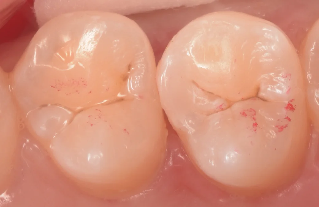 神奈川からお越しの歯科医師の方｜坂寄歯科医院（取手市藤代） - 画像3