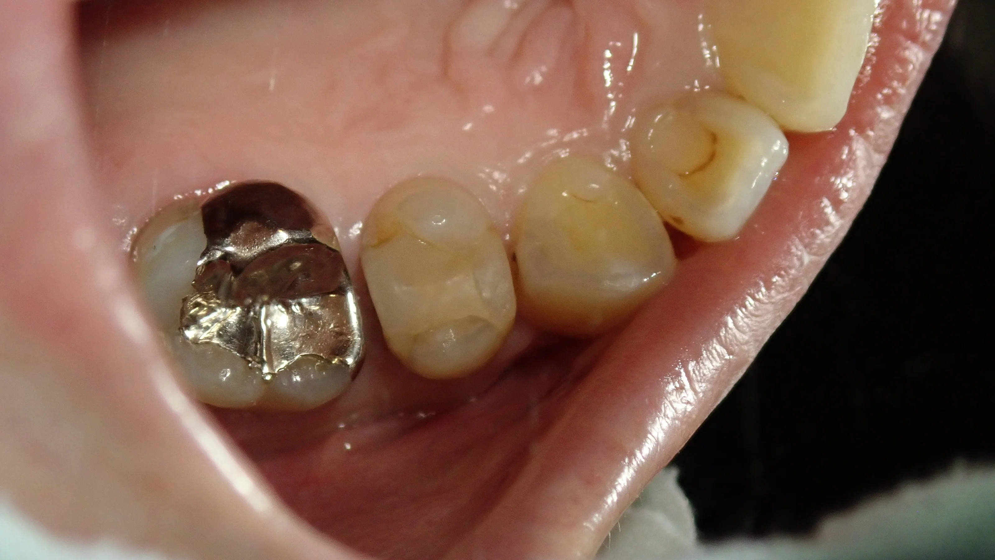 ブログ・お役立ち情報｜坂寄歯科医院（取手市藤代）