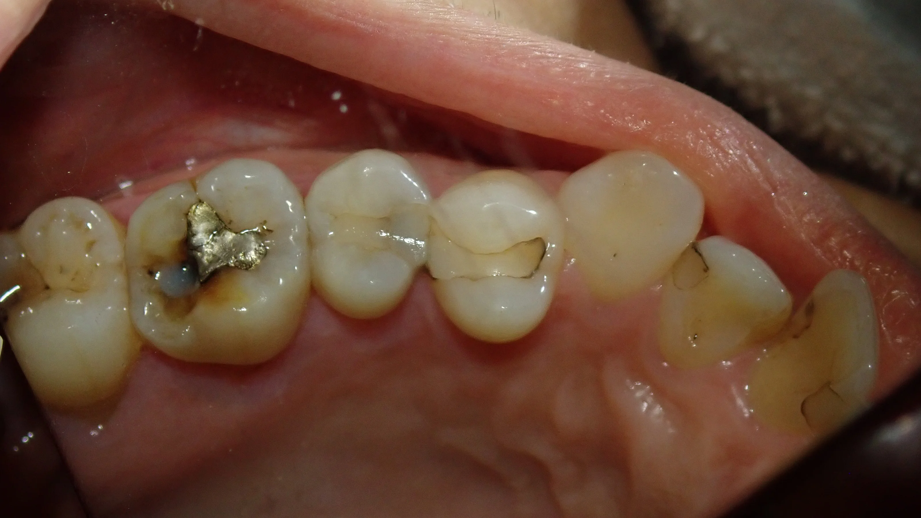 ブログ・お役立ち情報｜坂寄歯科医院（取手市藤代）