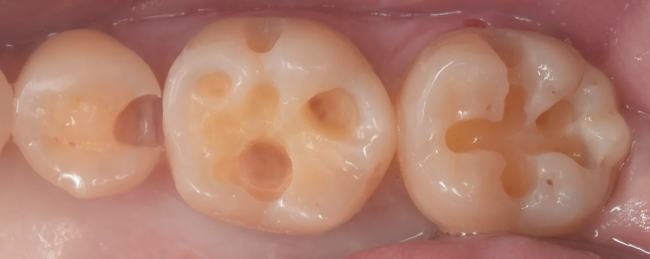 遠方からいらっしゃった歯科医師の方。｜坂寄歯科医院（取手市藤代） - 画像3