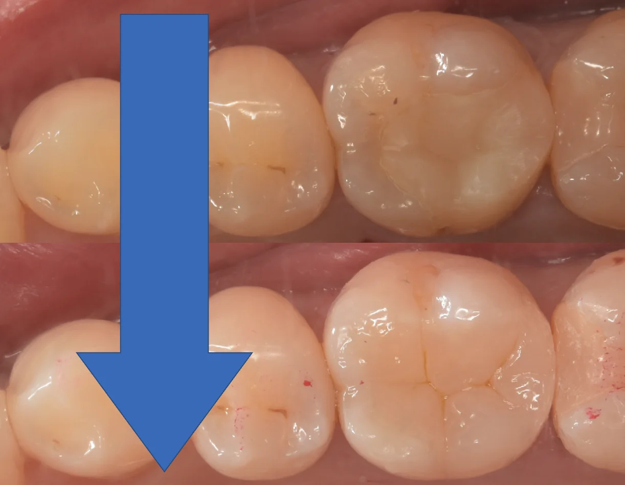 埼玉県からお越しの方｜坂寄歯科医院（取手市藤代） - 画像4