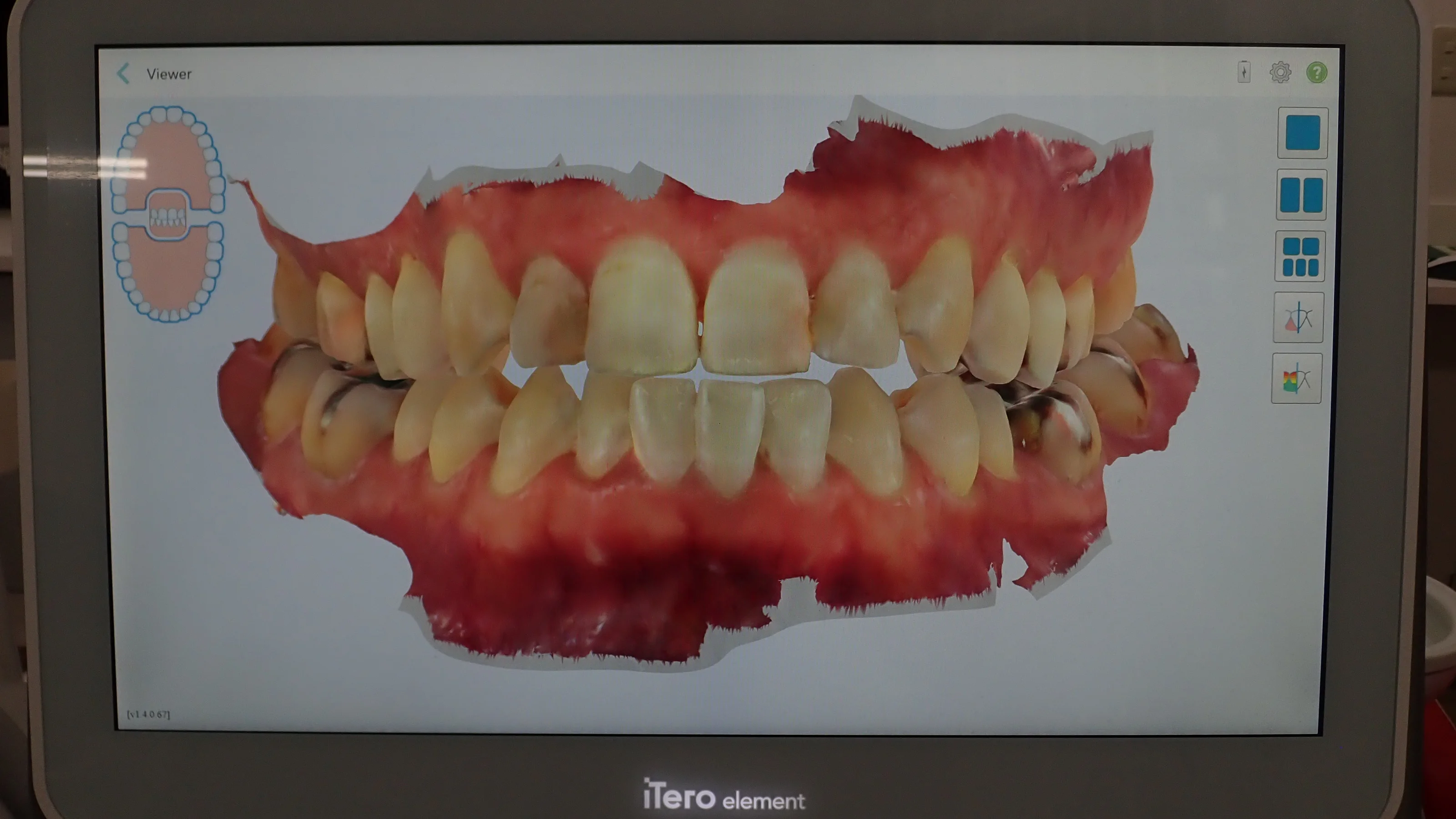 ブログ・お役立ち情報｜坂寄歯科医院（取手市藤代）