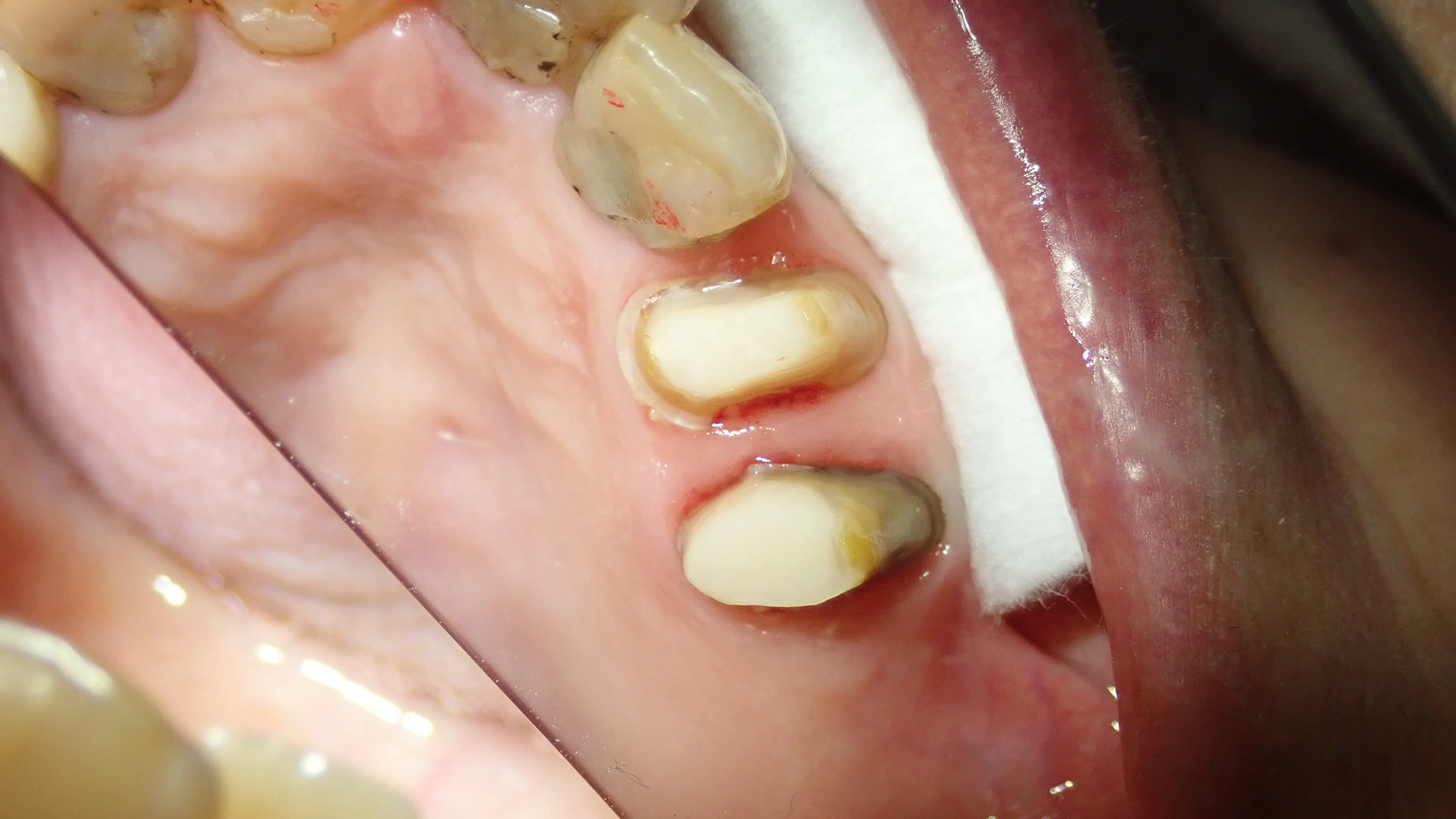 ブログ・お役立ち情報｜坂寄歯科医院（取手市藤代）