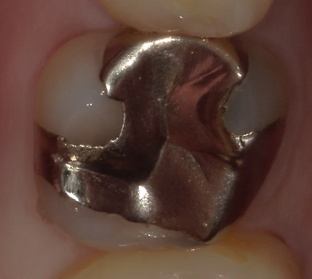 ブログ・お役立ち情報｜坂寄歯科医院（取手市藤代）