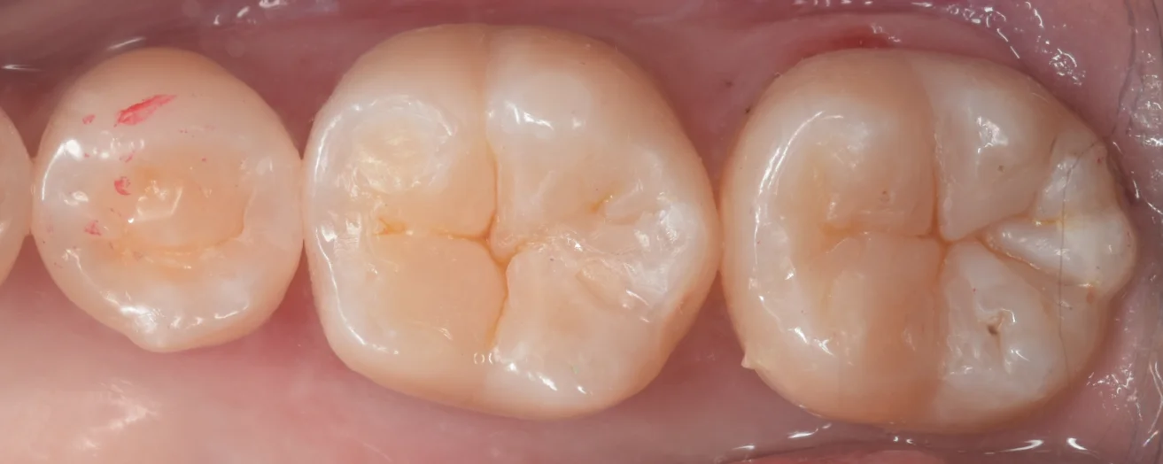 遠方からいらっしゃった歯科医師の方。｜坂寄歯科医院（取手市藤代） - 画像4