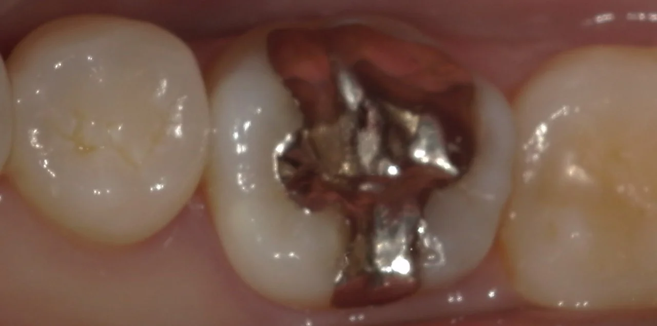 ブログ・お役立ち情報｜坂寄歯科医院（取手市藤代）