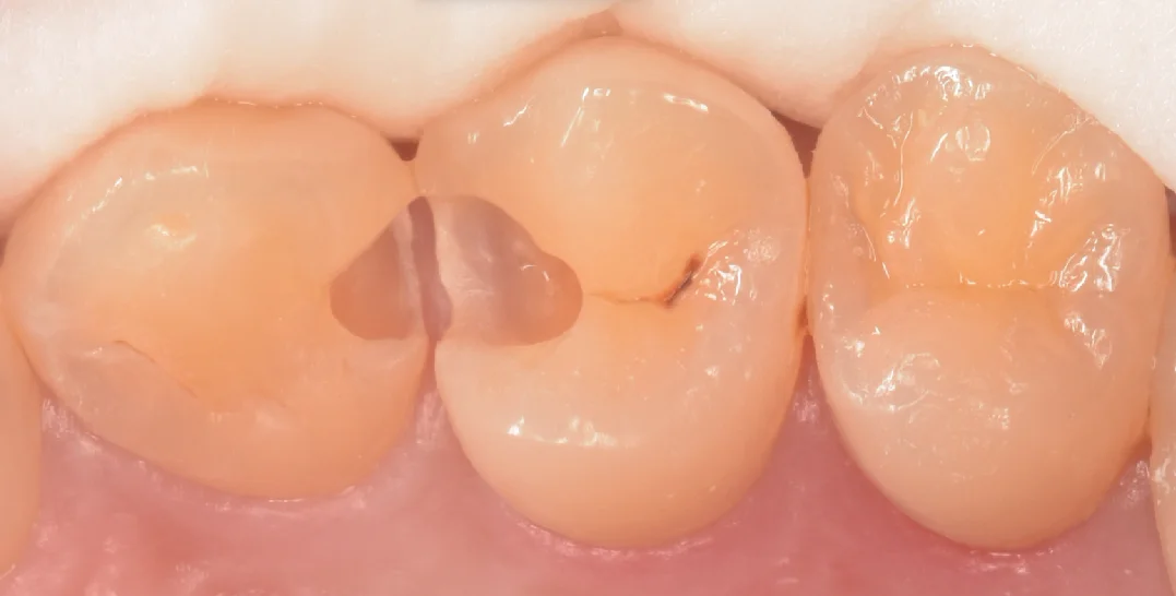 千葉からお越しの歯科衛生士さん。｜坂寄歯科医院（取手市藤代） - 画像3