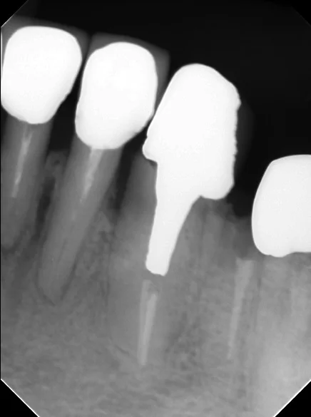 ブログ・お役立ち情報｜坂寄歯科医院（取手市藤代）