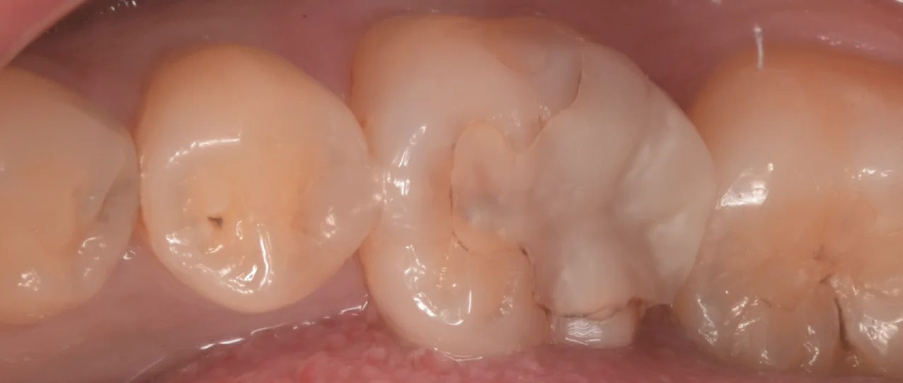 ブログ・お役立ち情報｜坂寄歯科医院（取手市藤代）