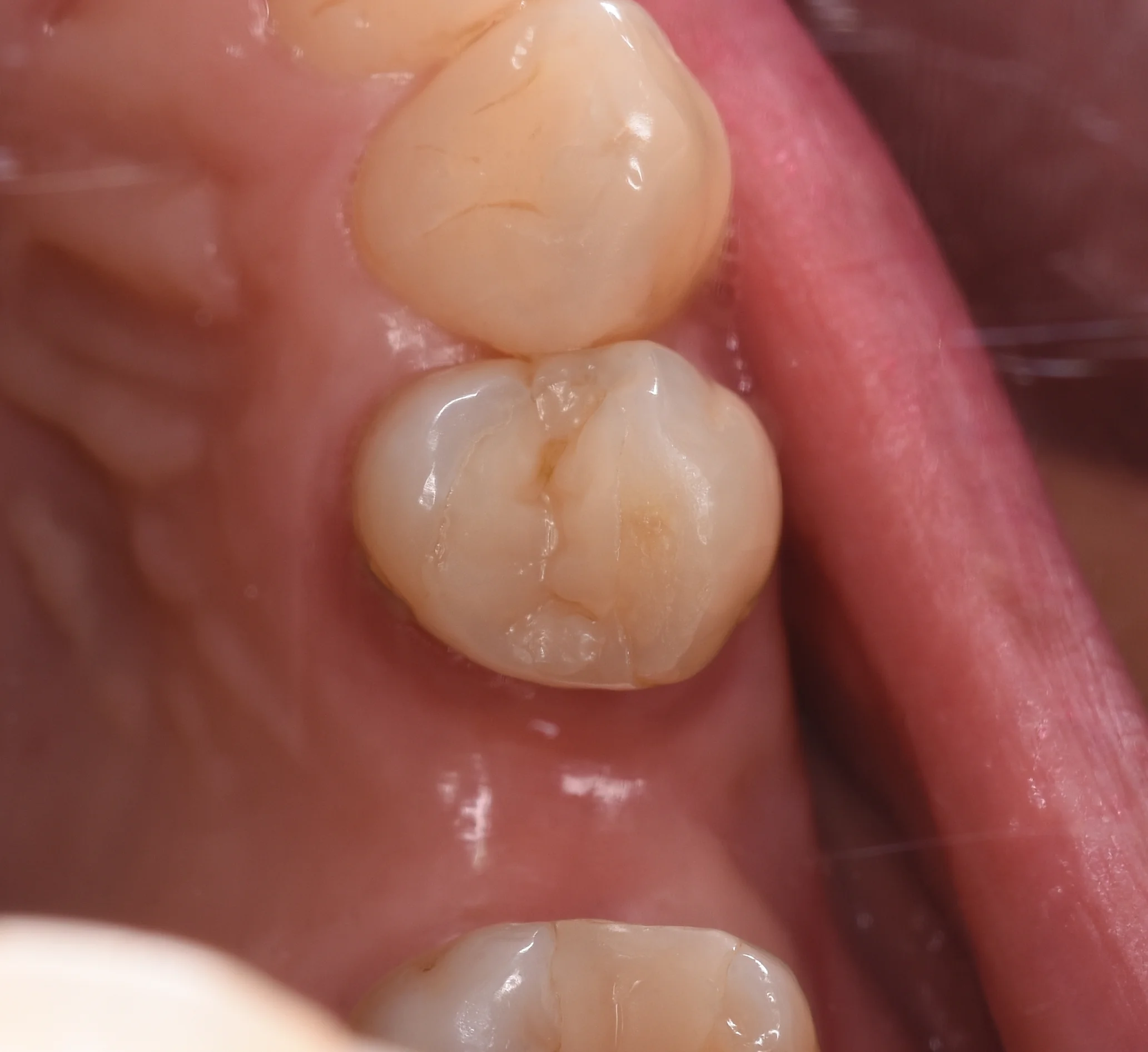 ブログ・お役立ち情報｜坂寄歯科医院（取手市藤代）