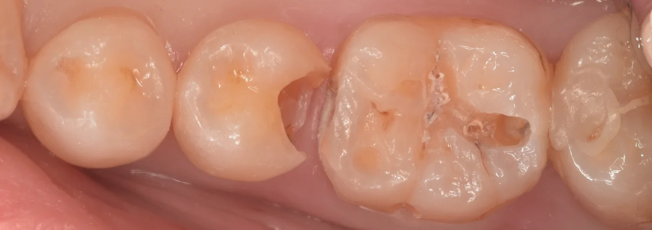 三鷹より来院された方｜坂寄歯科医院（取手市藤代） - 画像3