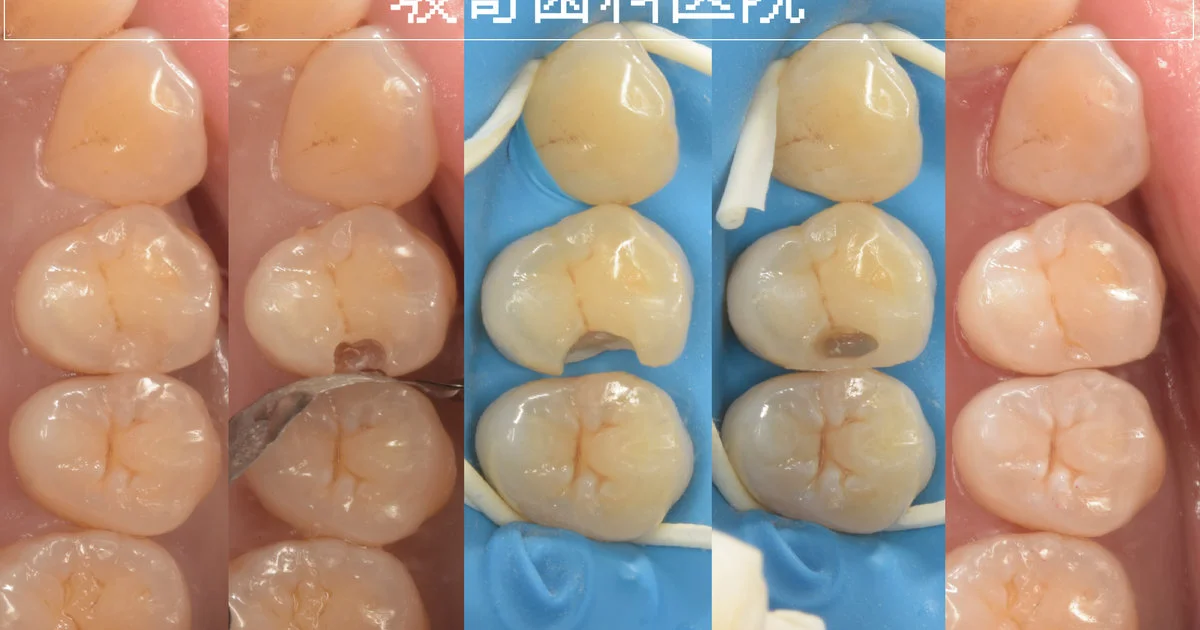 ブログ・お役立ち情報｜坂寄歯科医院（取手市藤代）