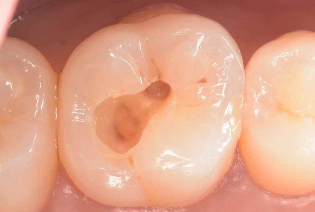 印西からお越しの方。｜坂寄歯科医院（取手市藤代） - 画像2