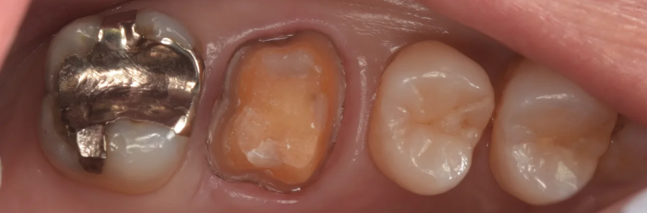 ブログ・お役立ち情報｜坂寄歯科医院（取手市藤代）