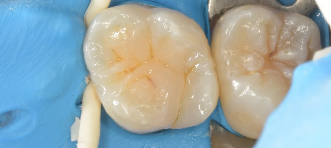 竜ヶ崎市からお越しの方。｜坂寄歯科医院（取手市藤代） - 画像4