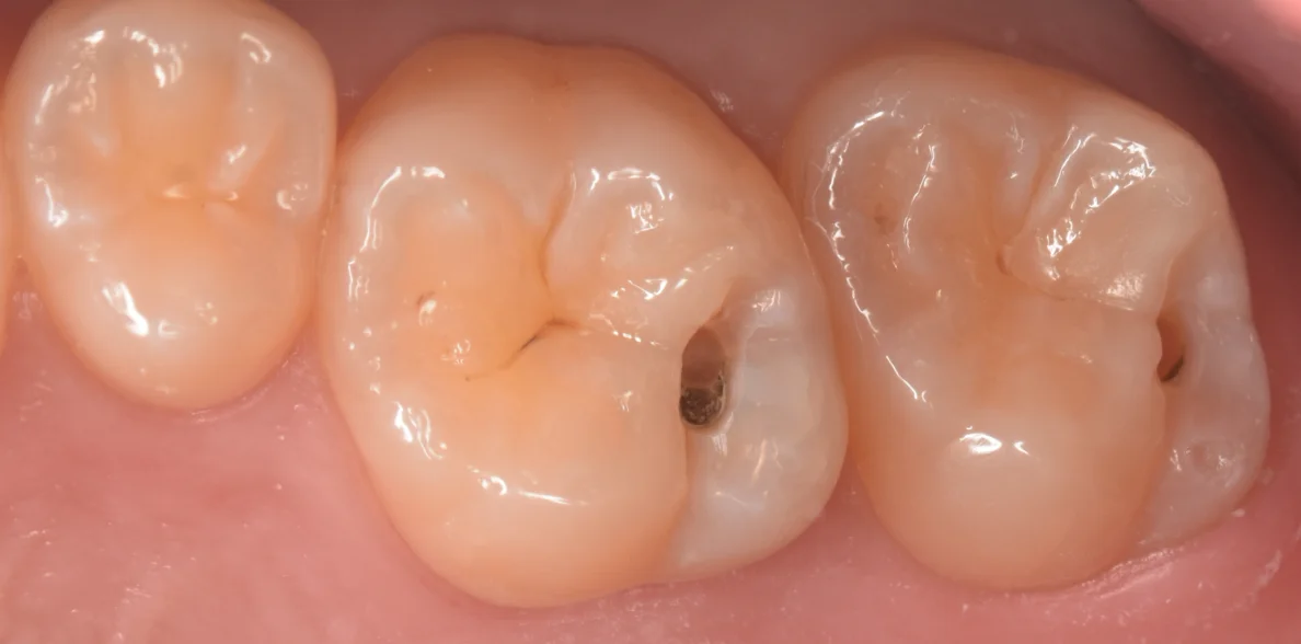 群馬からお越しの歯科医師の方。｜坂寄歯科医院（取手市藤代） - 画像2