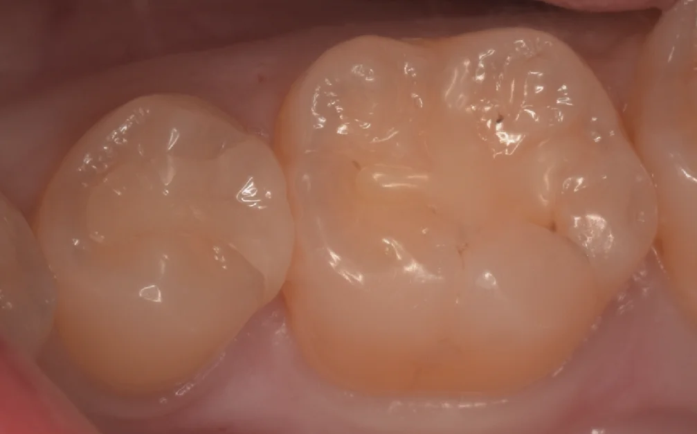 ブログ・お役立ち情報｜坂寄歯科医院（取手市藤代）