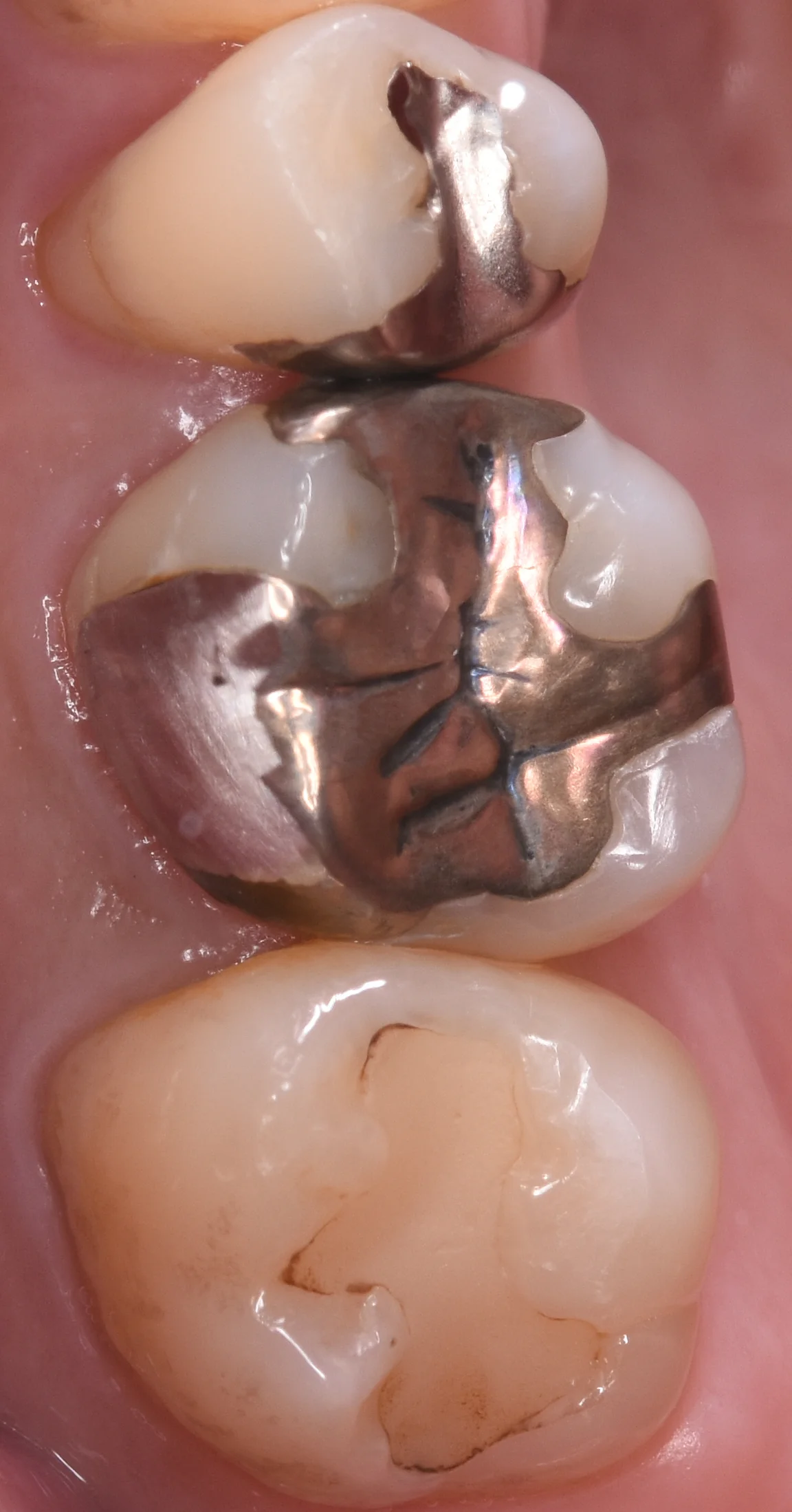 ブログ・お役立ち情報｜坂寄歯科医院（取手市藤代）