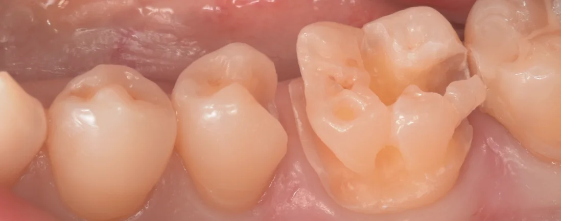 三鷹より来院された方｜坂寄歯科医院（取手市藤代） - 画像6