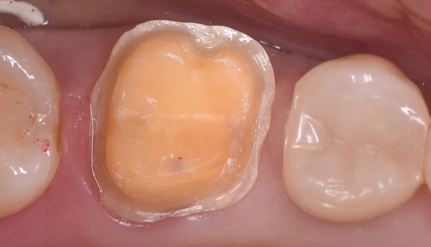 ブログ・お役立ち情報｜坂寄歯科医院（取手市藤代）