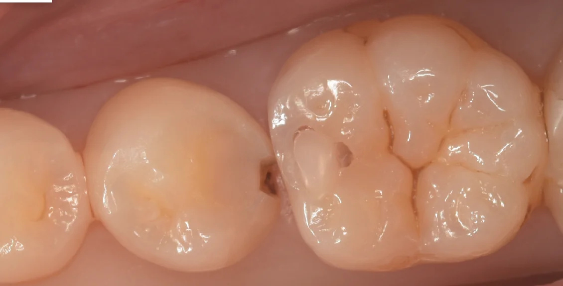 ブログ・お役立ち情報｜坂寄歯科医院（取手市藤代）