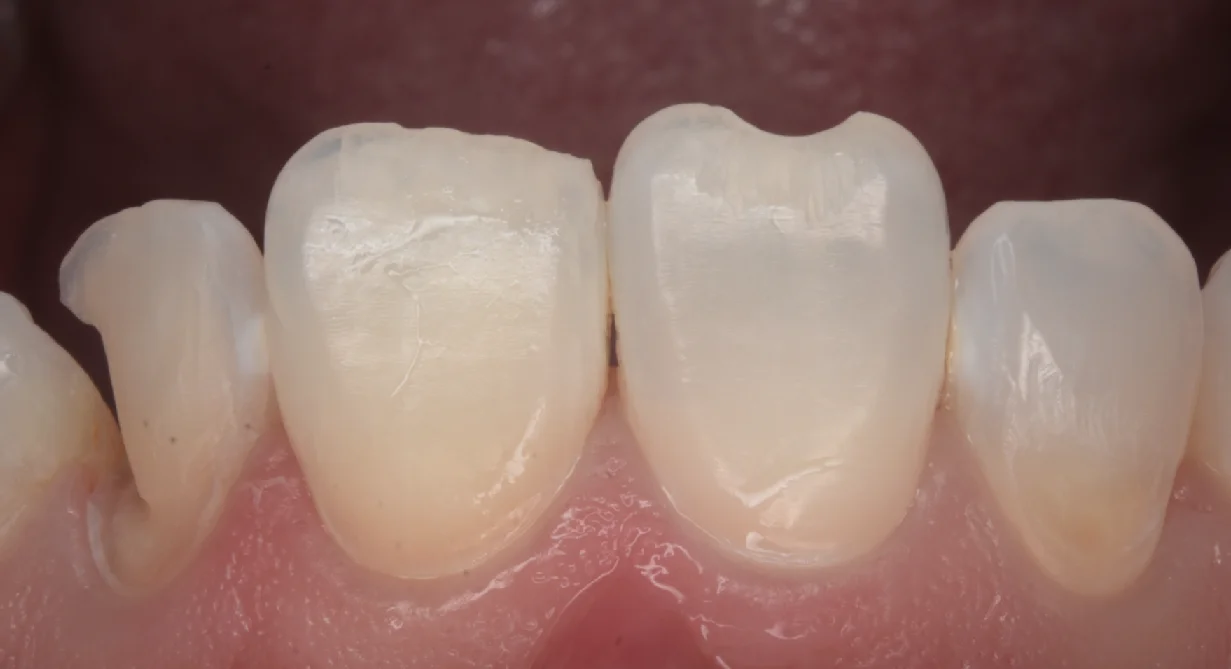 目黒からお越しの方｜坂寄歯科医院（取手市藤代） - 画像2