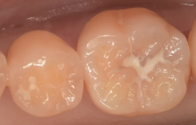 ブログ・お役立ち情報｜坂寄歯科医院（取手市藤代）