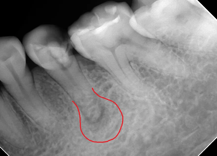 ブログ・お役立ち情報｜坂寄歯科医院（取手市藤代）