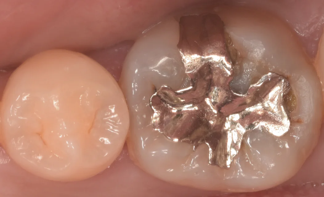 ブログ・お役立ち情報｜坂寄歯科医院（取手市藤代）