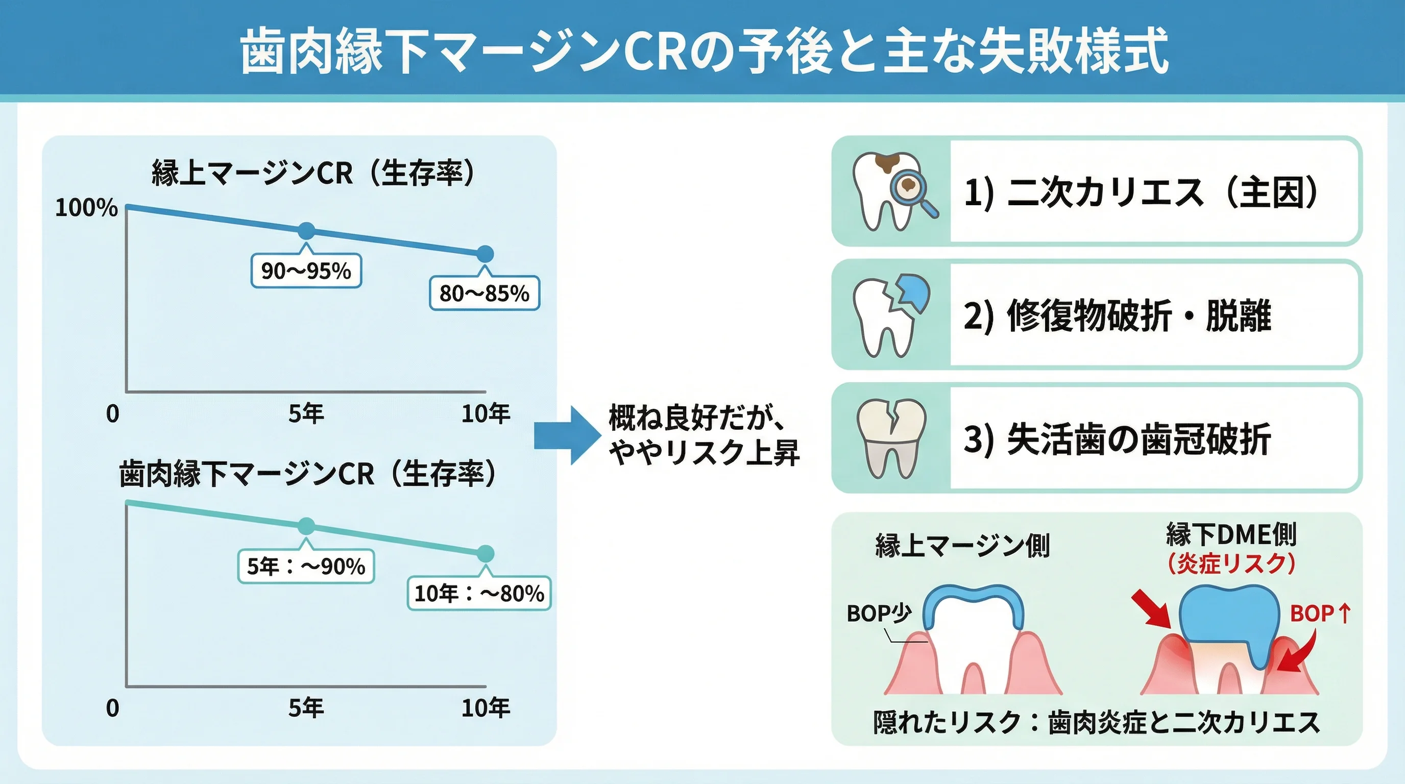 縁上マージンCRと歯肉縁下マージンCRの5年・10年の生存率と、二次カリエス・修復物破折／脱離・失活歯の歯冠破折・歯肉炎リスクなど主な失敗様式を示したグラフとイラスト