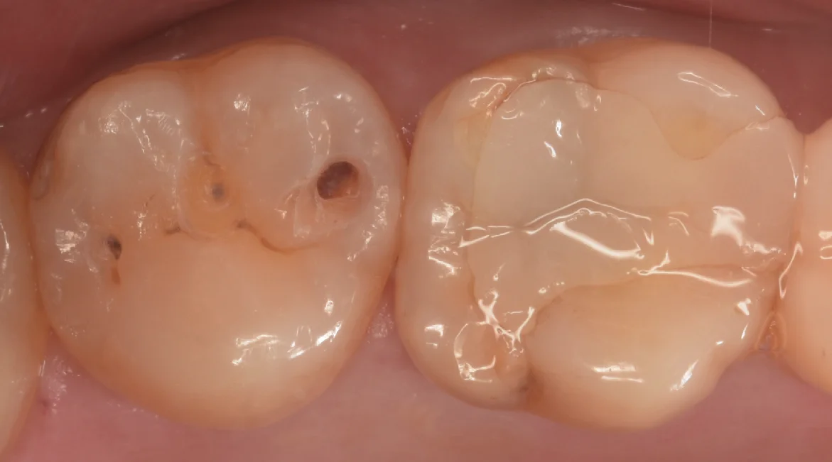 他県より来院された方。｜坂寄歯科医院（取手市藤代） - 画像2