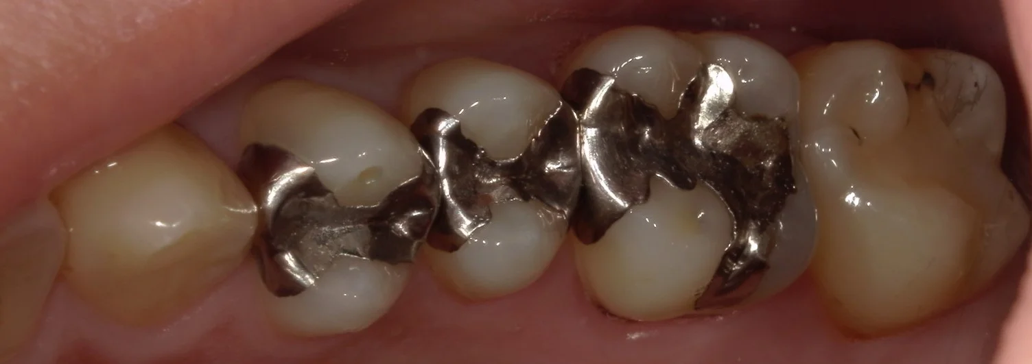 ブログ・お役立ち情報｜坂寄歯科医院（取手市藤代）