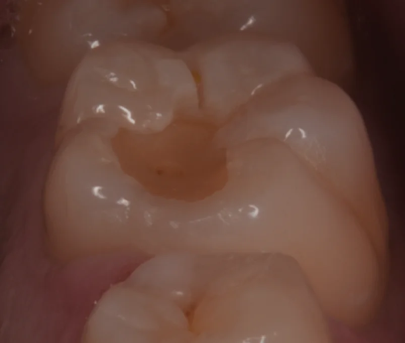 歯学部生をダイレクトで。｜坂寄歯科医院（取手市藤代） - 画像2