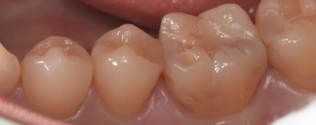 三鷹より来院された方｜坂寄歯科医院（取手市藤代） - 画像2