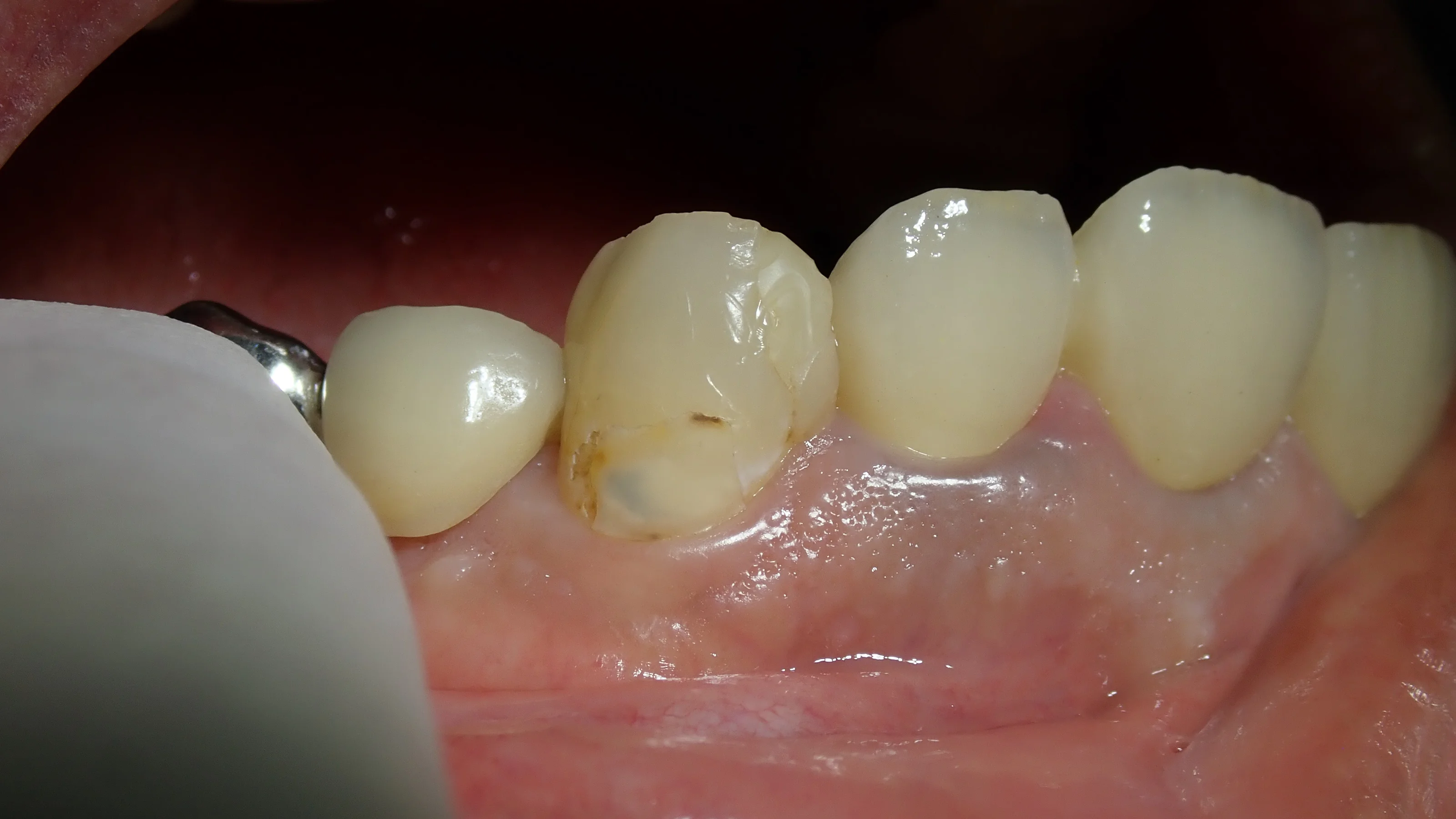 ブログ・お役立ち情報｜坂寄歯科医院（取手市藤代）