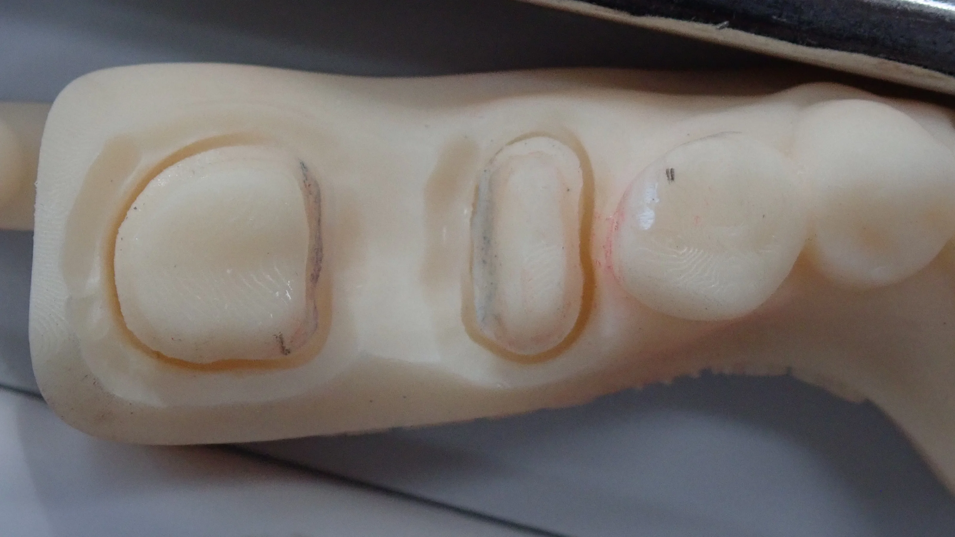 その抜歯ちょっと待って!|坂寄歯科医院(取手市藤代) - 画像4