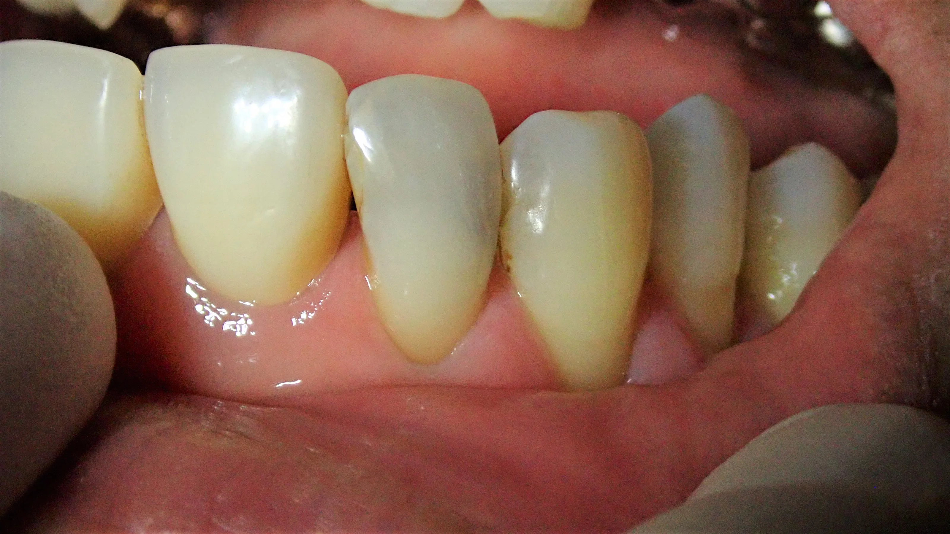 ブログ・お役立ち情報｜坂寄歯科医院（取手市藤代）