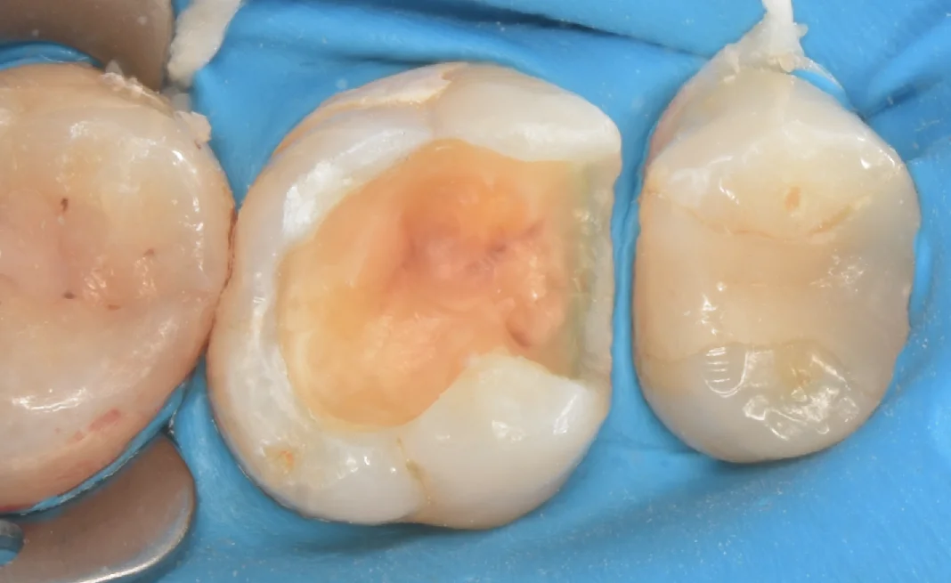 新宿からお越しの方｜坂寄歯科医院（取手市藤代） - 画像2