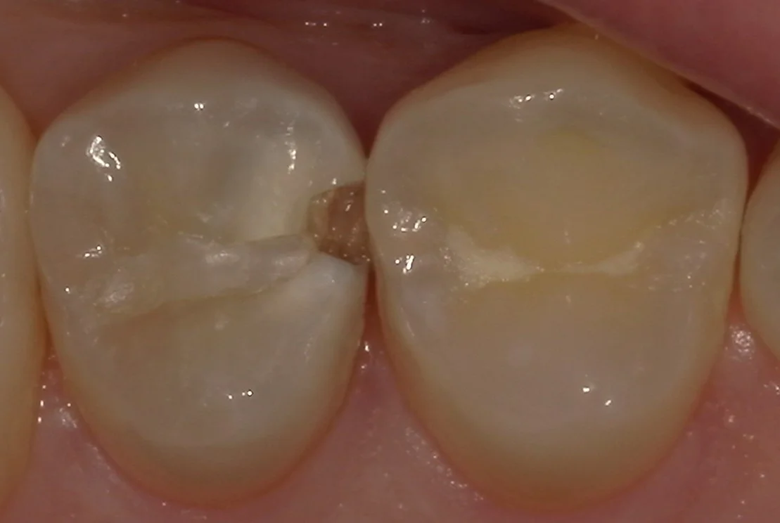 ブログ・お役立ち情報｜坂寄歯科医院（取手市藤代）