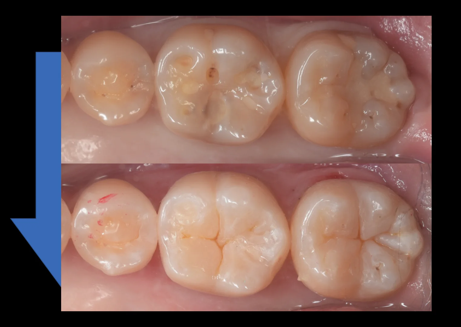 遠方からいらっしゃった歯科医師の方。｜坂寄歯科医院（取手市藤代） - 画像5