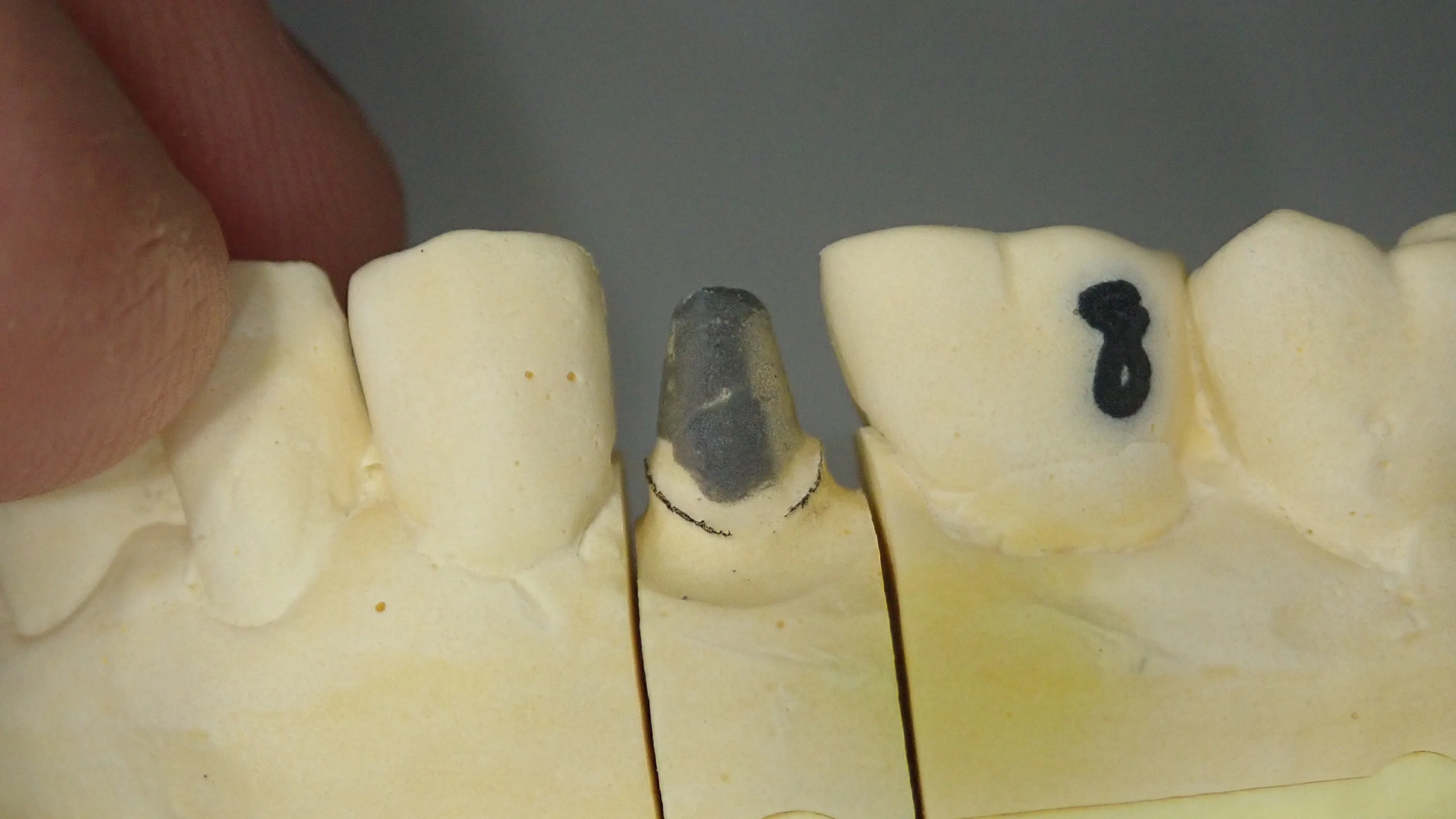 ブログ・お役立ち情報｜坂寄歯科医院（取手市藤代）