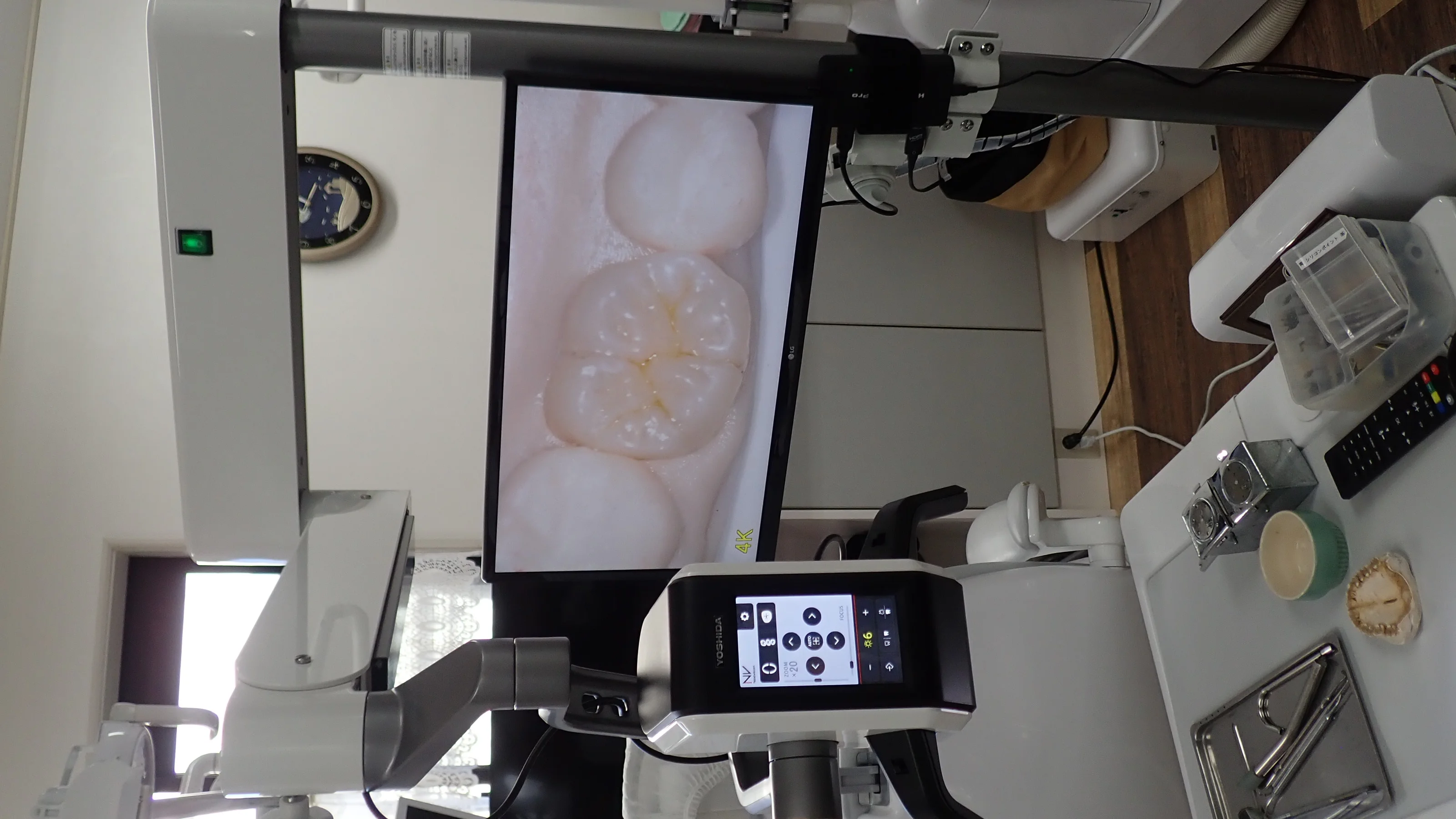 ブログ・お役立ち情報｜坂寄歯科医院（取手市藤代）