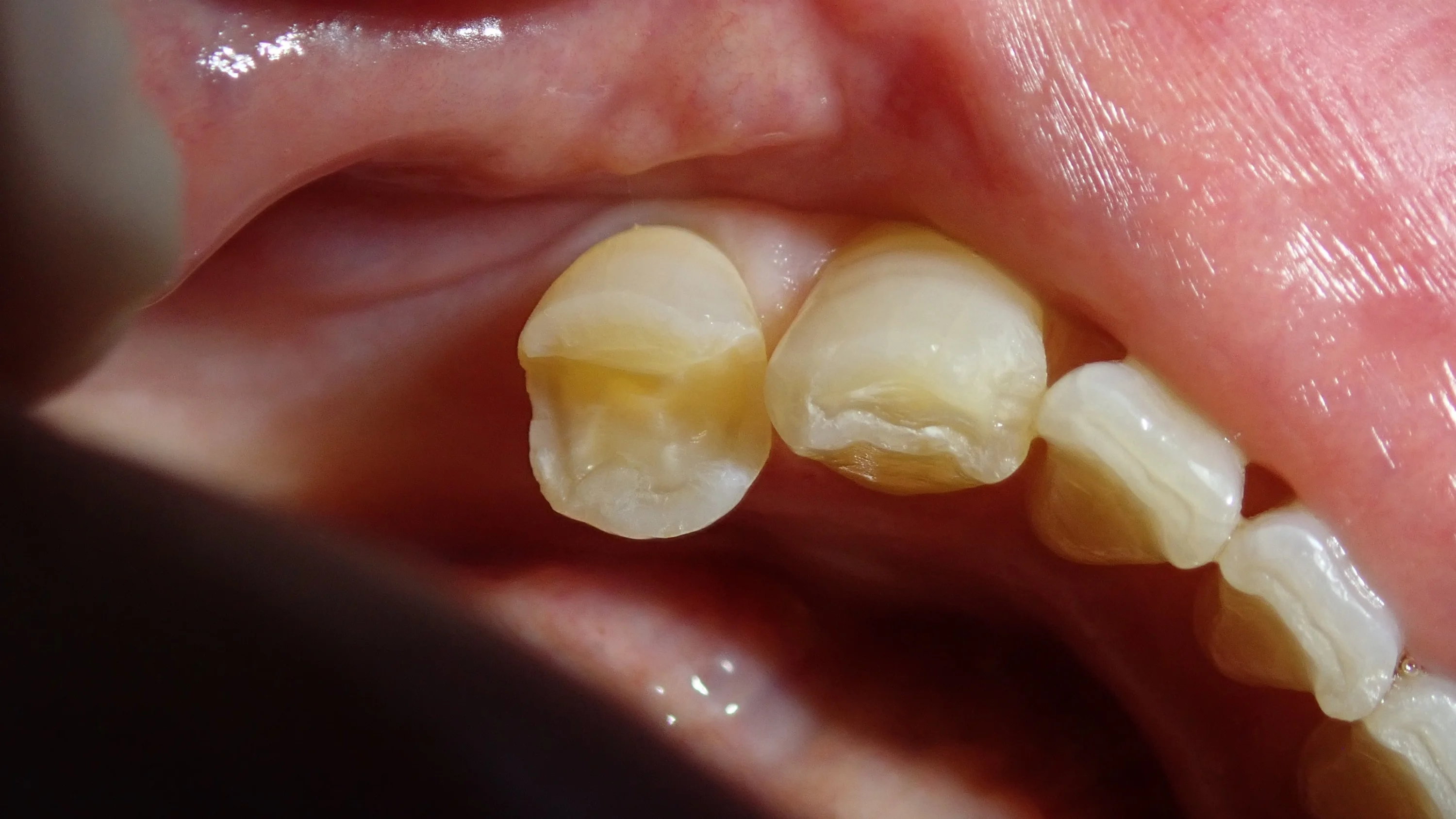 ブログ・お役立ち情報｜坂寄歯科医院（取手市藤代）