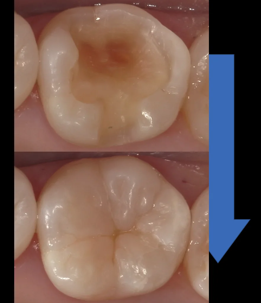 ブログ・お役立ち情報｜坂寄歯科医院（取手市藤代）