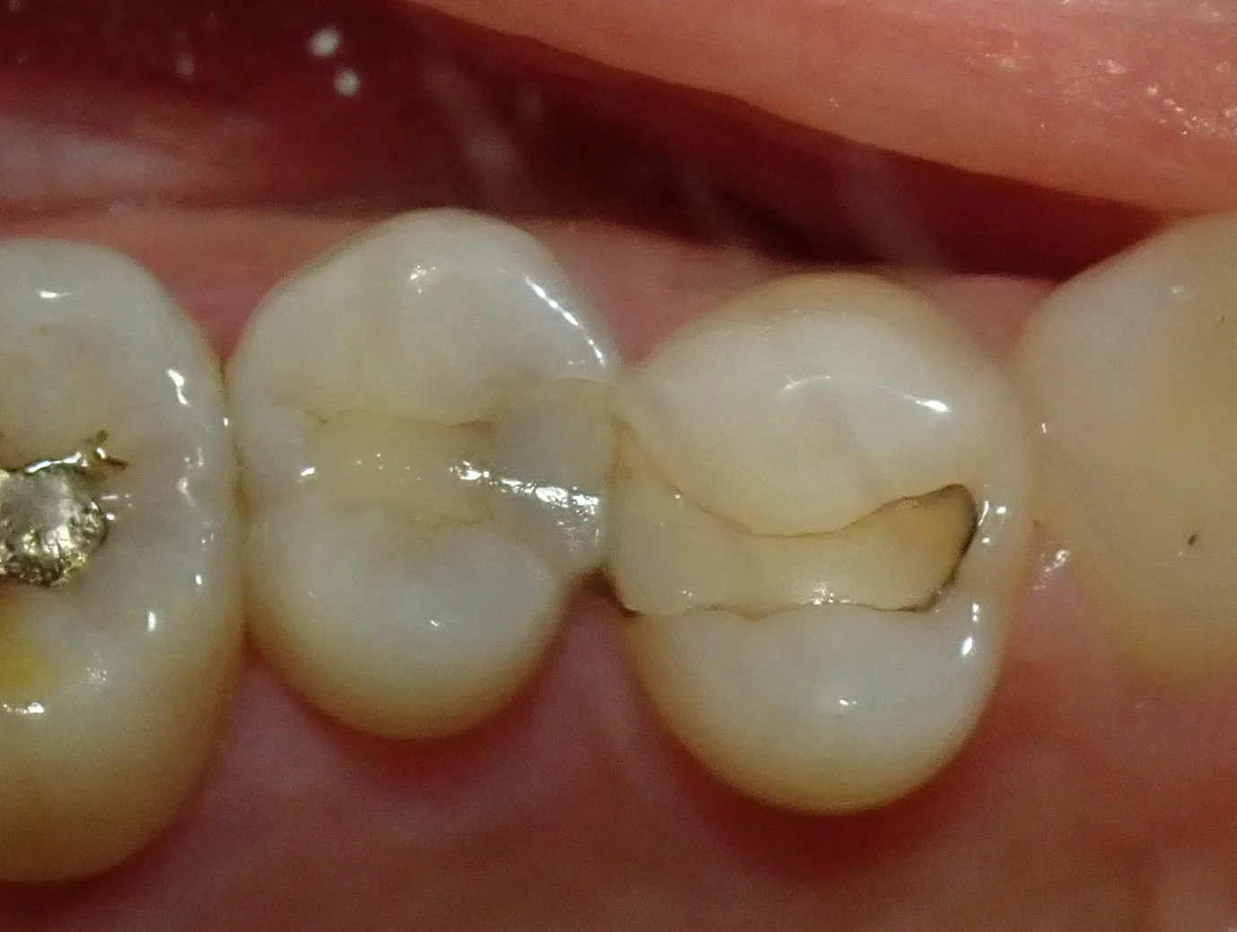 ブログ・お役立ち情報｜坂寄歯科医院（取手市藤代）