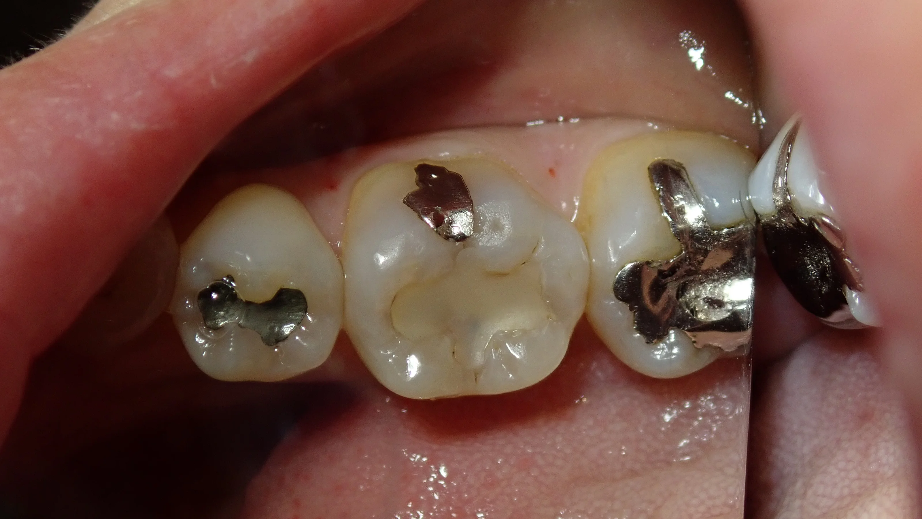 ブログ・お役立ち情報｜坂寄歯科医院（取手市藤代）