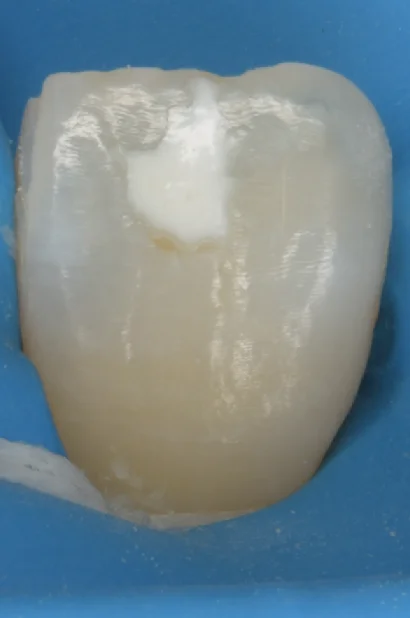 ブログ・お役立ち情報｜坂寄歯科医院（取手市藤代）