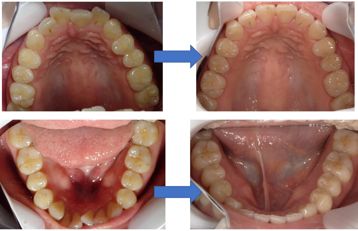 ブログ・お役立ち情報｜坂寄歯科医院（取手市藤代）