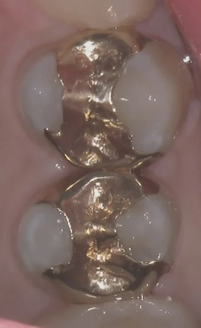 ブログ・お役立ち情報｜坂寄歯科医院（取手市藤代）